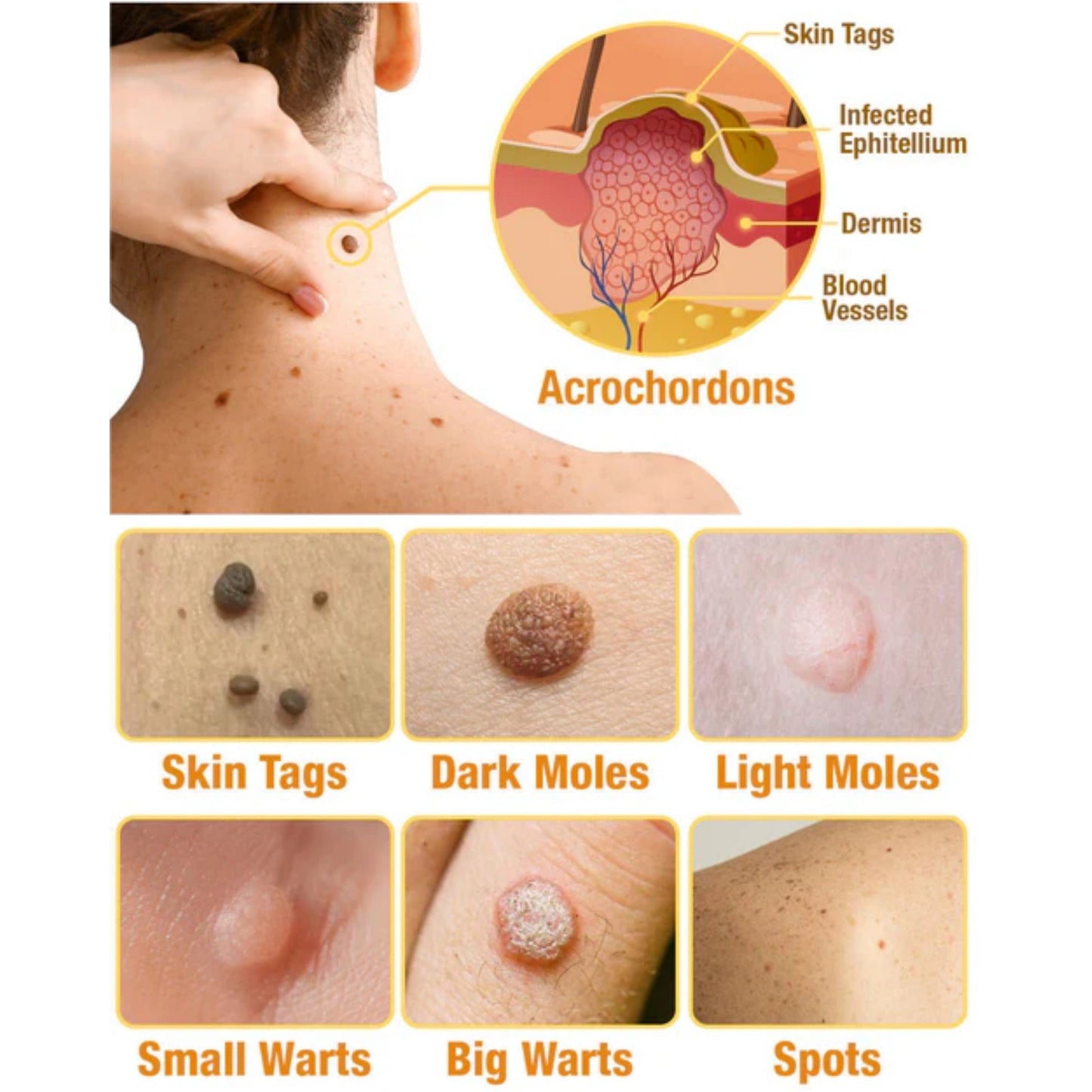 đTagRecede Bee Venom Treatment Spray