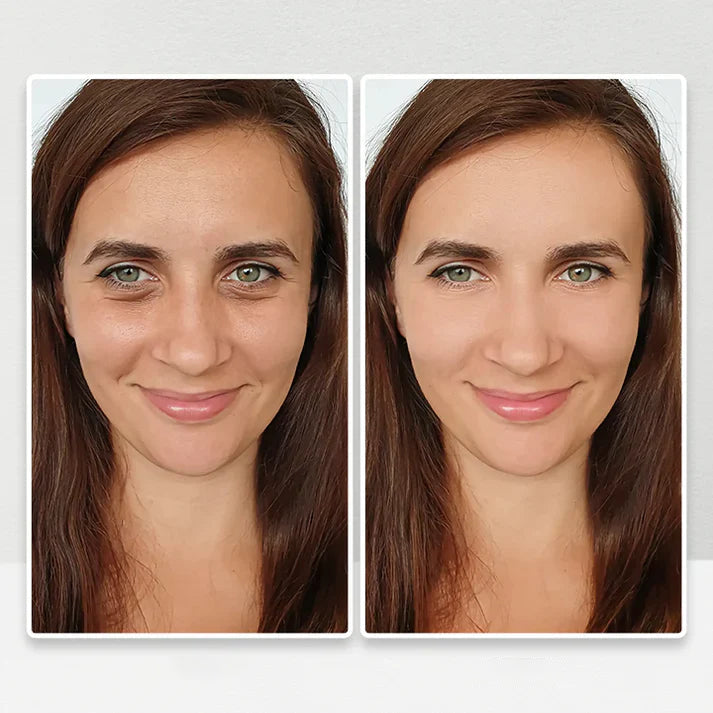 Crème de réduction anti-âge rapide (✨2 achetés 1 offert💕)