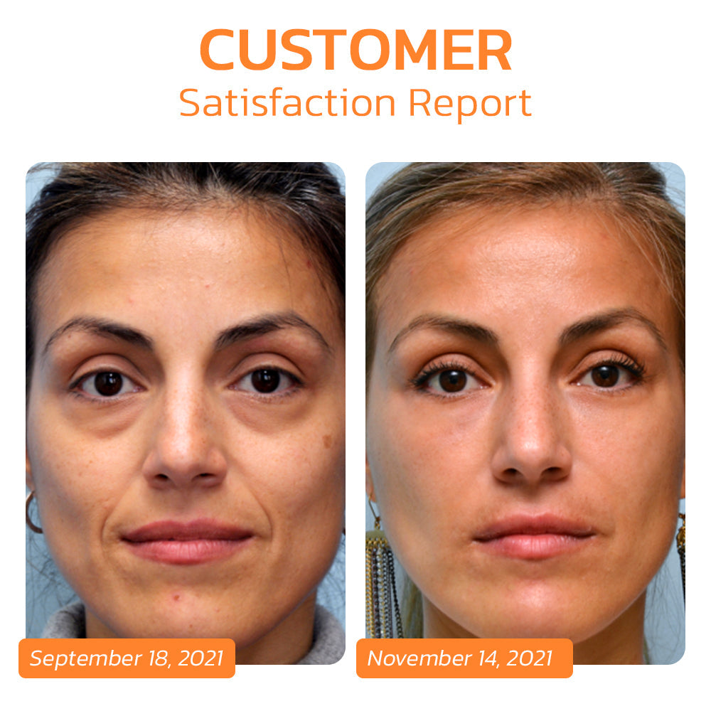 EELHOE Soluble Collagen Film