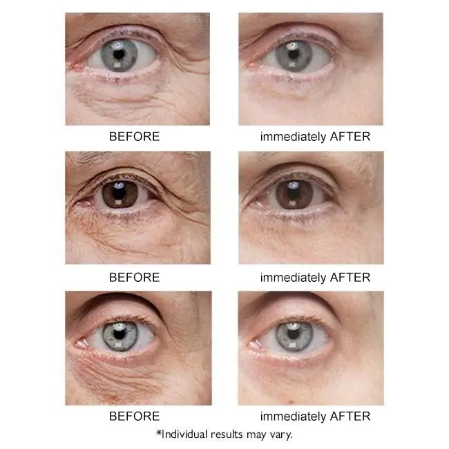 Κρέμα ματιών Sadoer Collagen