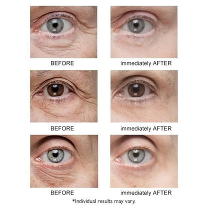 Κρέμα ματιών Sadoer Collagen
