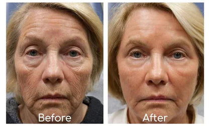 Κρέμα ματιών Sadoer Collagen