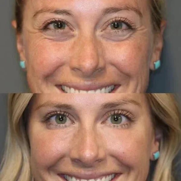 Κρέμα ματιών Sadoer Collagen