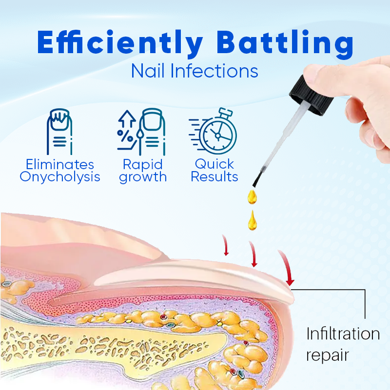 Oulisi ™ Nagelwachstum und Reparaturserum