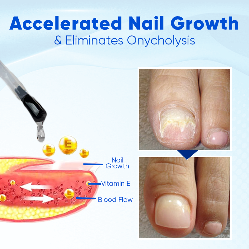 Oulisi ™ Nagelwachstum und Reparaturserum
