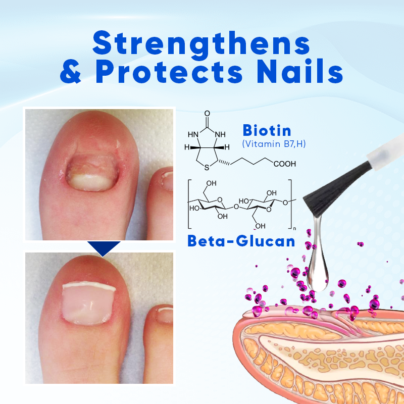 Oulisi ™ Nagelwachstum und Reparaturserum